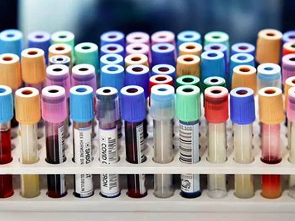 Blood test tube in soft laboratory light